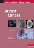 Portada de BREAST CANCER