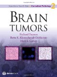 Portada de BRAIN TUMORS