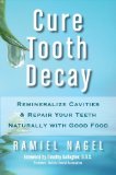 Portada de CURE TOOTH DECAY: REMINERALIZE CAVITIES AND REPAIR YOUR TEETH NATURALLY WITH GOOD FOOD BY NAGEL, RAMIEL (2010) PAPERBACK